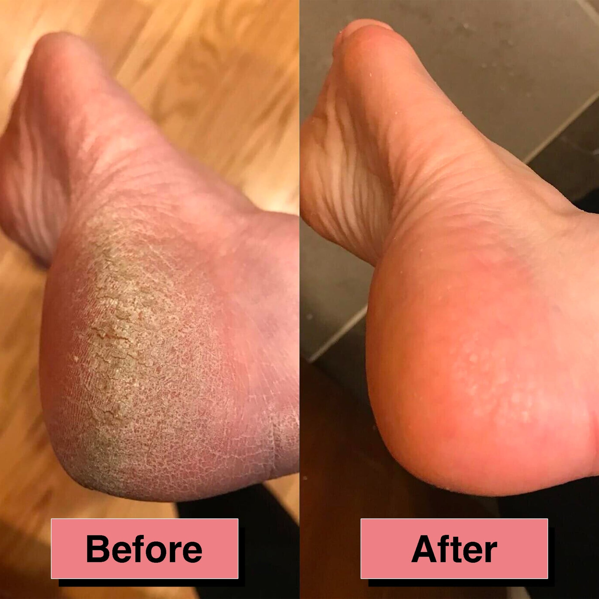 Electric callus remover - Launchify