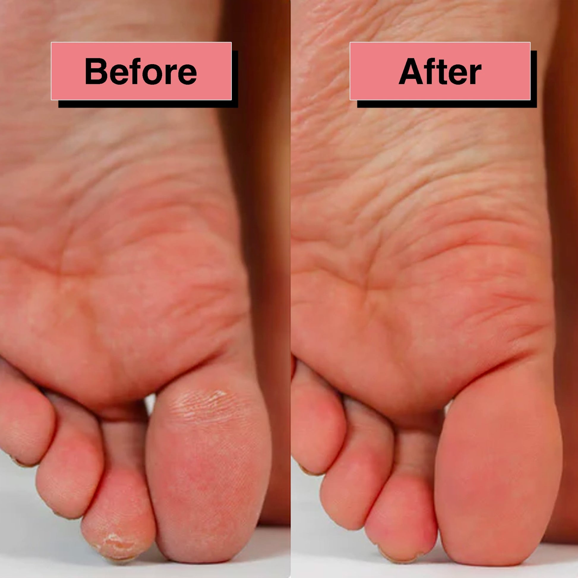 Electric callus remover - Launchify