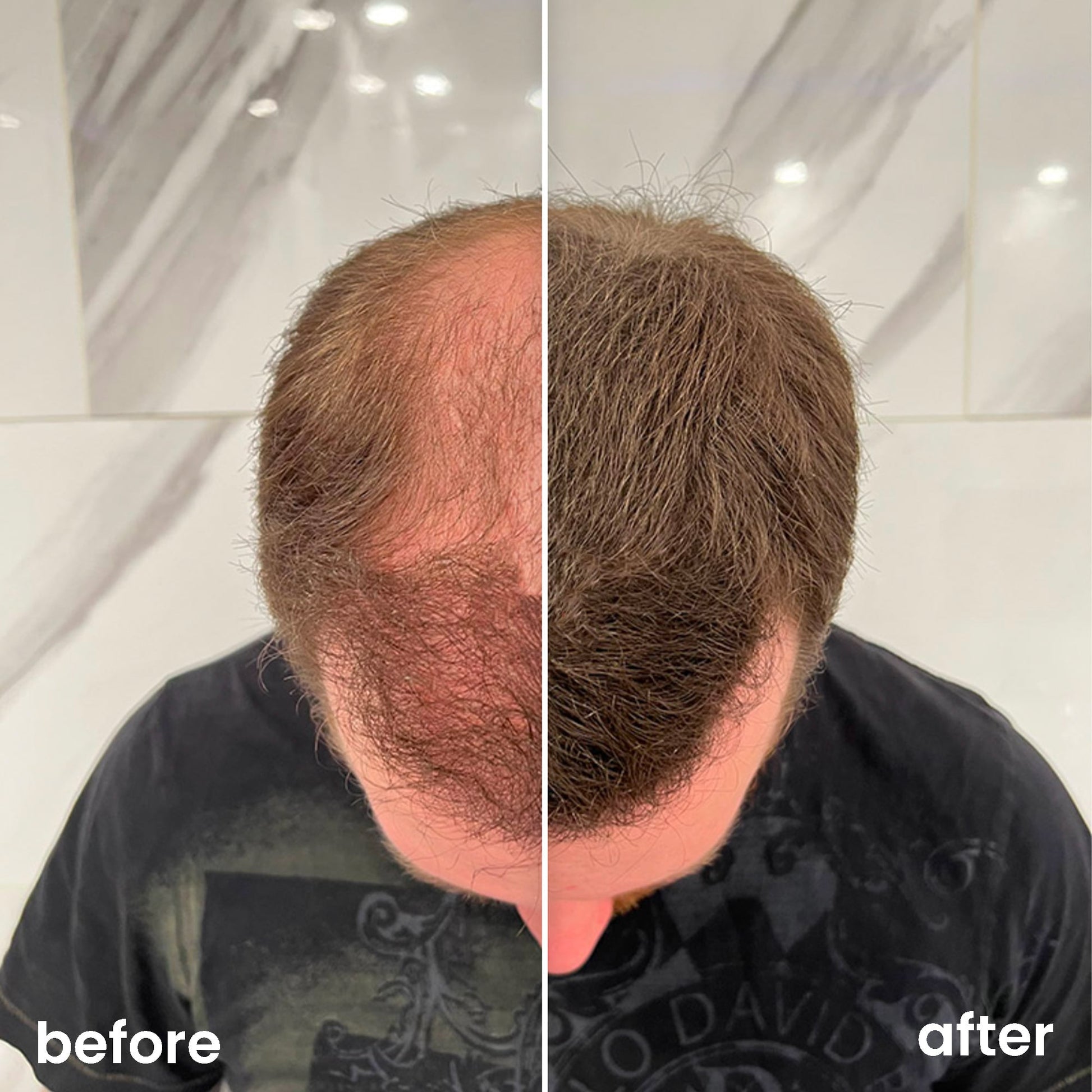 Hair Fibers - Launchify